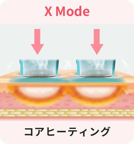 スタートクリニック麻布十番 オリジオ X コアヒーティング