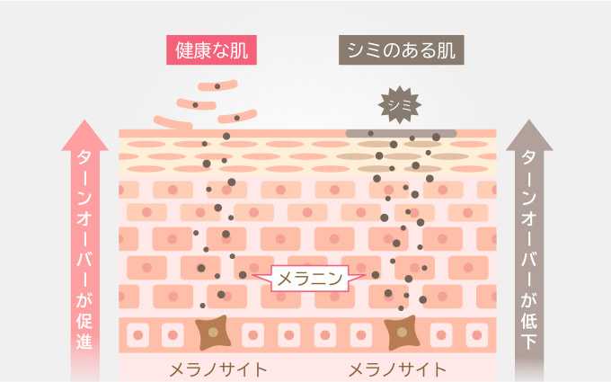 シミ、くすみ、小じわ、ニキビの改善に効果的な治療